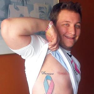 male-breast-cancer-2